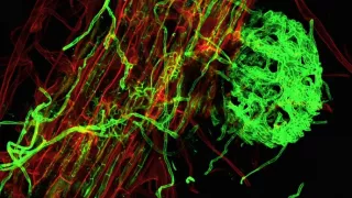 Tajemné stromy - dokonalé přírodní systémy (2/2)