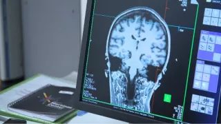 Psychika šampiónů