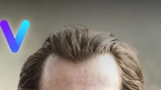 Metóda Markovič: Hojer (6)