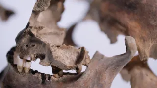 Anatomie ukřižování