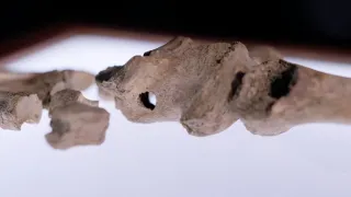 Anatomie ukřižování