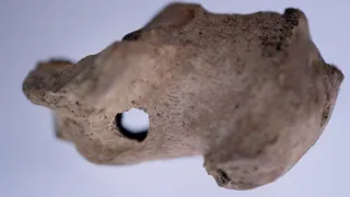 Anatomie ukřižování