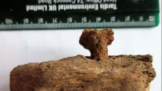 Anatomie ukřižování