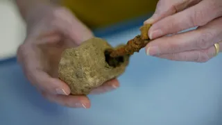 Anatomie ukřižování