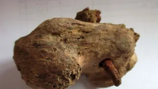 Anatomie ukřižování