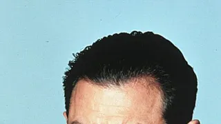 Reťaz bláznov