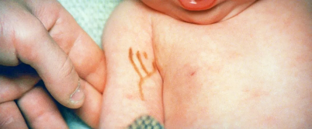 Willow, 1988 - fotogaléria